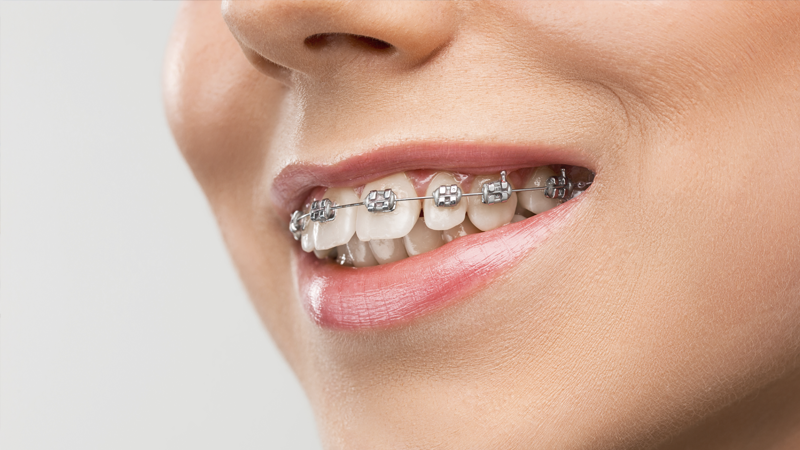 Ortodonti için faydalı bir rehber