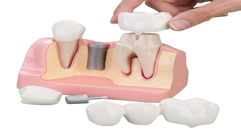 Basic instruments and tools for dental students